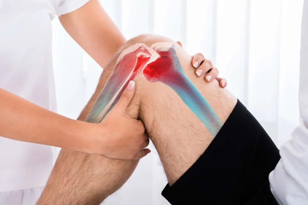 ACL Knee PT1