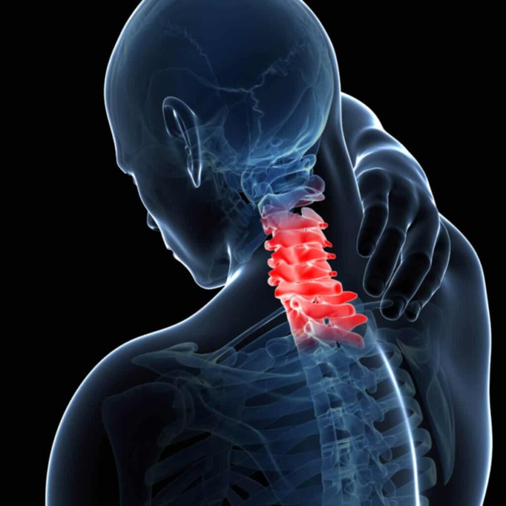 Whiplash Injury Treatment To The Neck Pain GoogFI