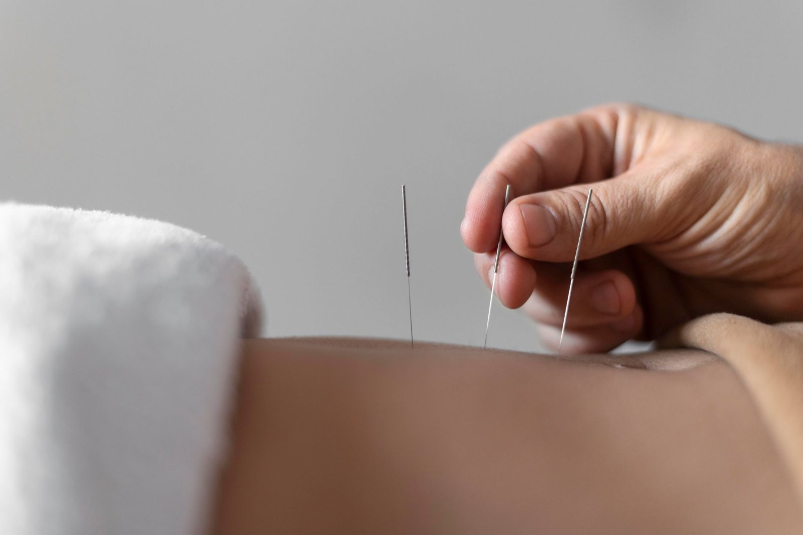 close up hand holding acupuncture needle