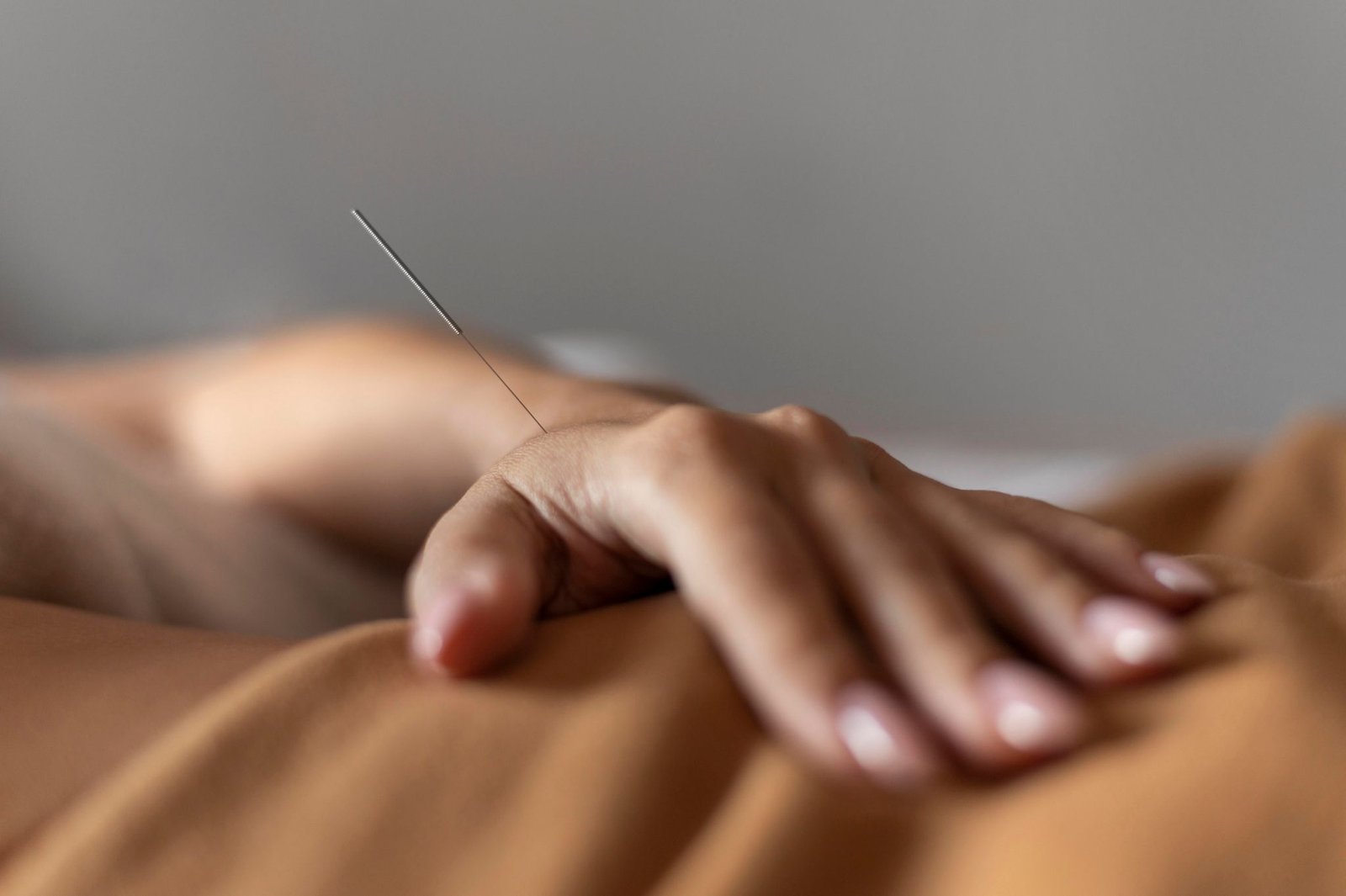 Close Up Hand With Acupuncture Needle