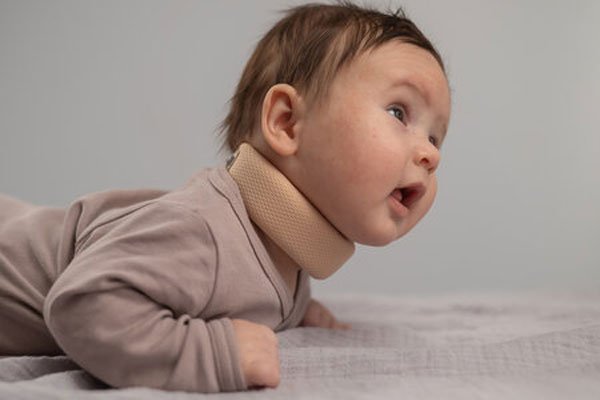Torticollis